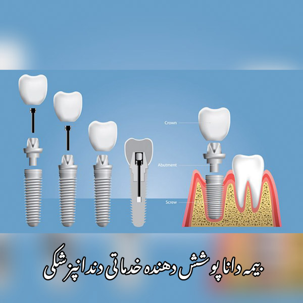 بیمه دانا پوشش دهنده خدمات دندانپزشکی 